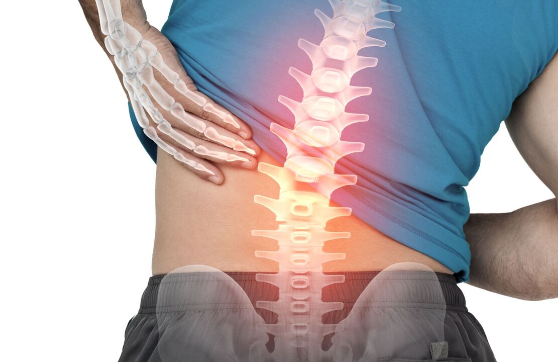 Risk of ostechondrosis of the lumbar