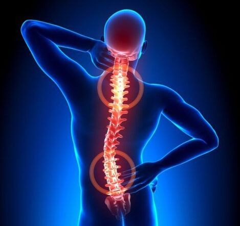 Osteochondrosis of the spine