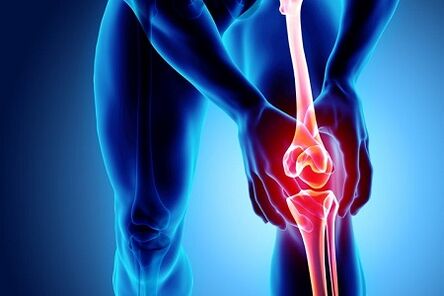 arthrosis