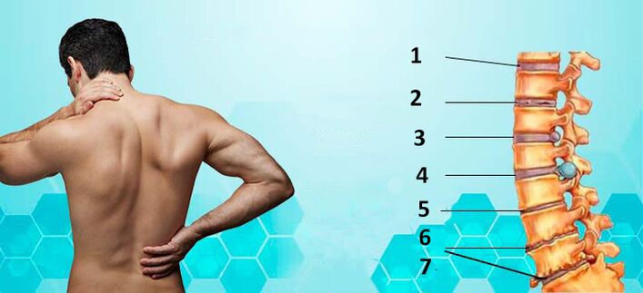 Stages of development of osteochondrosis